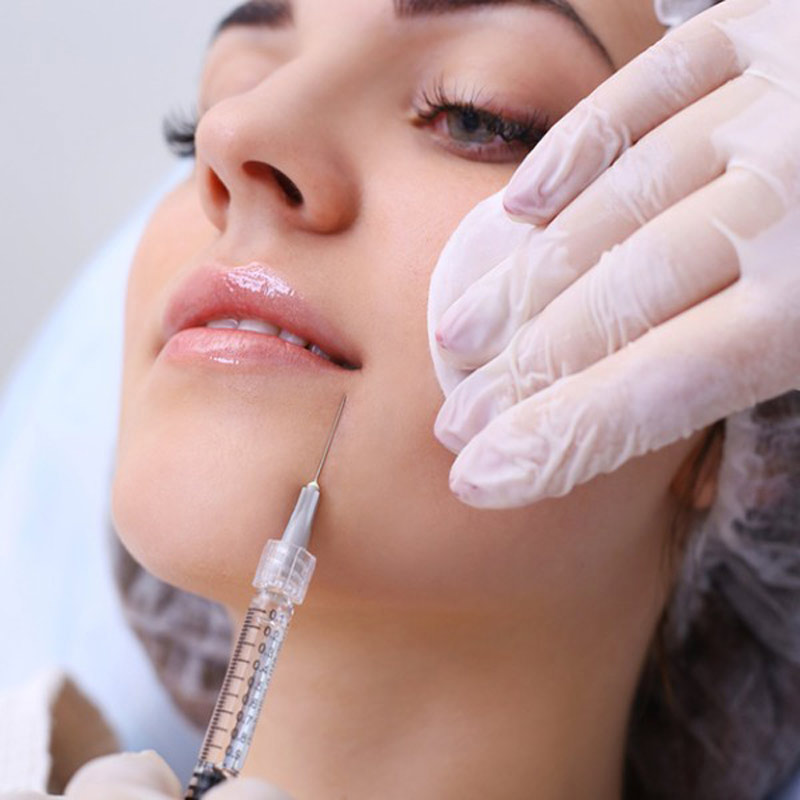 بوتاکس برای خط لبخند