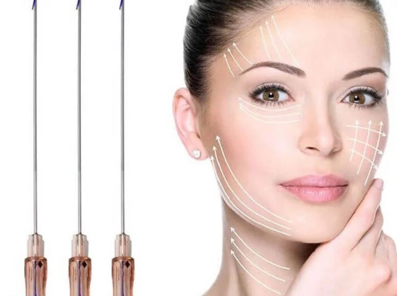 بوتاکس بهتره یا نخ