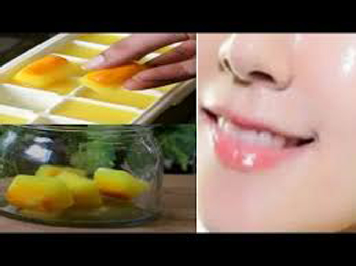 بوتاکس صورت با یخ زردچوبه