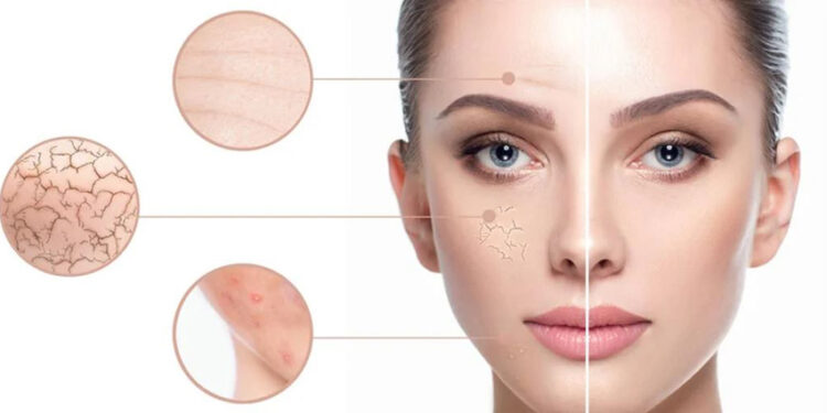 انتخاب بین بوتاکس و اگزوزوم