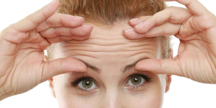 بوتاکس خانگی پیشانی