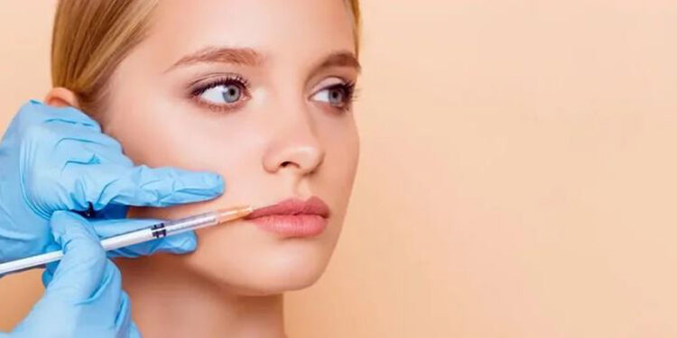 بوتاکس دور لب یا اگزوزوم