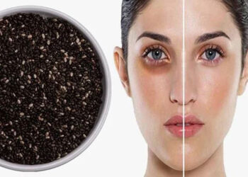 بوتاکس صورت با تخم شربتی