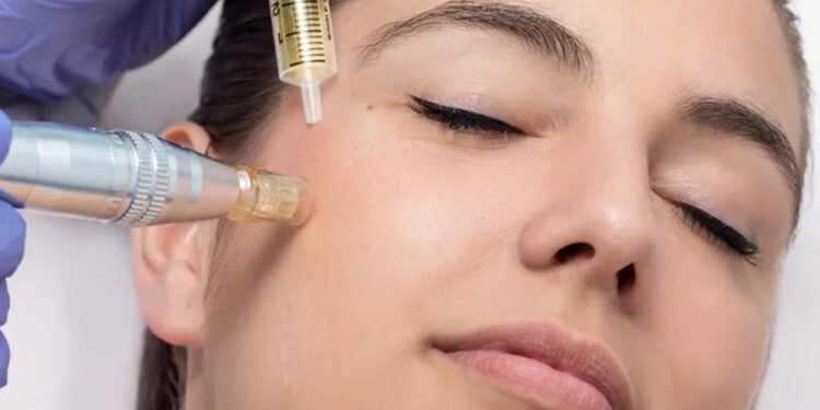 ماندگاری بوتاکس یا اگزوزوم