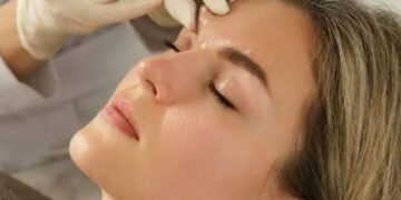 تزریق صحیح بوتاکس برای داشتن ابروهای طبیعی