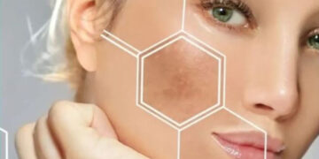 اگزوزوم صورت جدیدترین روش جوانسازی