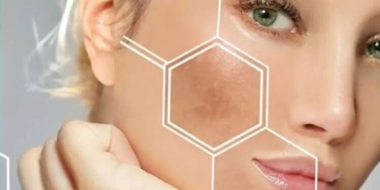 اگزوزوم صورت جدیدترین روش جوانسازی