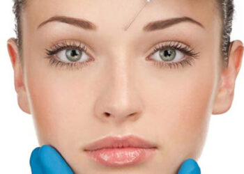 بوتاکس طبیعی صورت بدون حالت منجمد