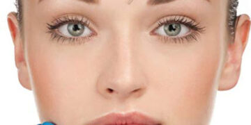 بوتاکس طبیعی صورت بدون حالت منجمد