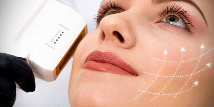 جایگزین بوتاکس با هایفو لیفت اولتراسوند