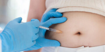 آیا بوتاکس معده برای لاغری موثر است