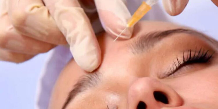 بوتاکس پیشگیرانه صورت