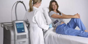 بوتاکس لاغری یا کرایولیپولیز کدام موثرتر