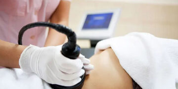 بوتاکس لاغری یا RF فرکشنال