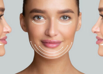 بوتاکس ماستر فک باریک بدون جراحی