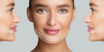 بوتاکس ماستر فک باریک بدون جراحی