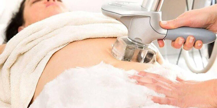 بوتاکس لاغری یا اولتراپی