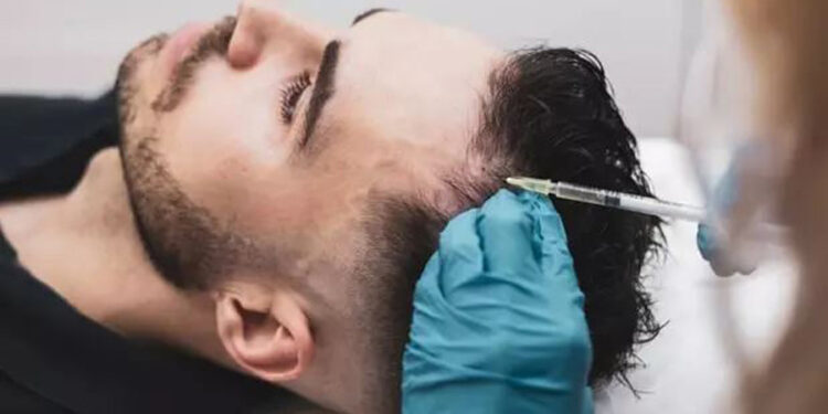 اگزوزوم برای درمان ریزش مو