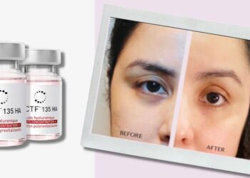 روش جوانسازی صورت ان سی تی اف