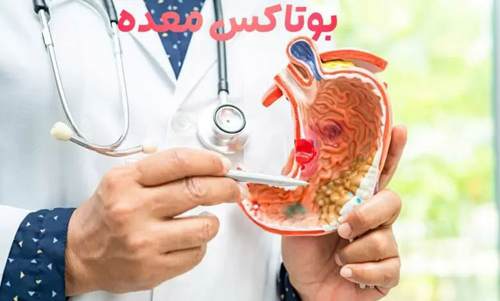 تزریق بوتاکس معده برای لاغری