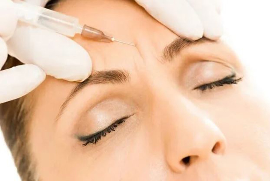 بوتاکس خط اخم یا فیلر برای خط اخم