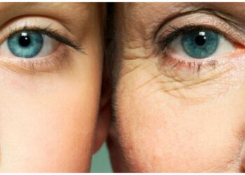 بوتاکس صورت با بلوبری