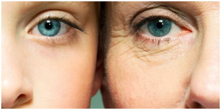 بوتاکس صورت با بلوبری