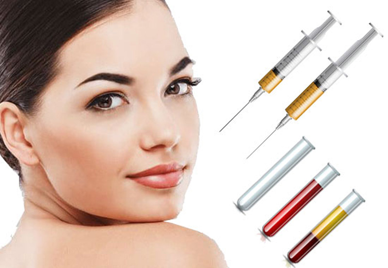 پی آر پی بعد از بوتاکس