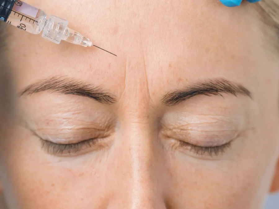 تزریق بوتاکس برای درمان چروک صورت یا تزریق NAD