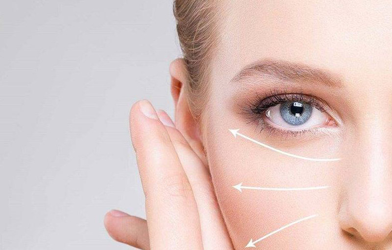 تفاوت لیفت صورت و بوتاکس