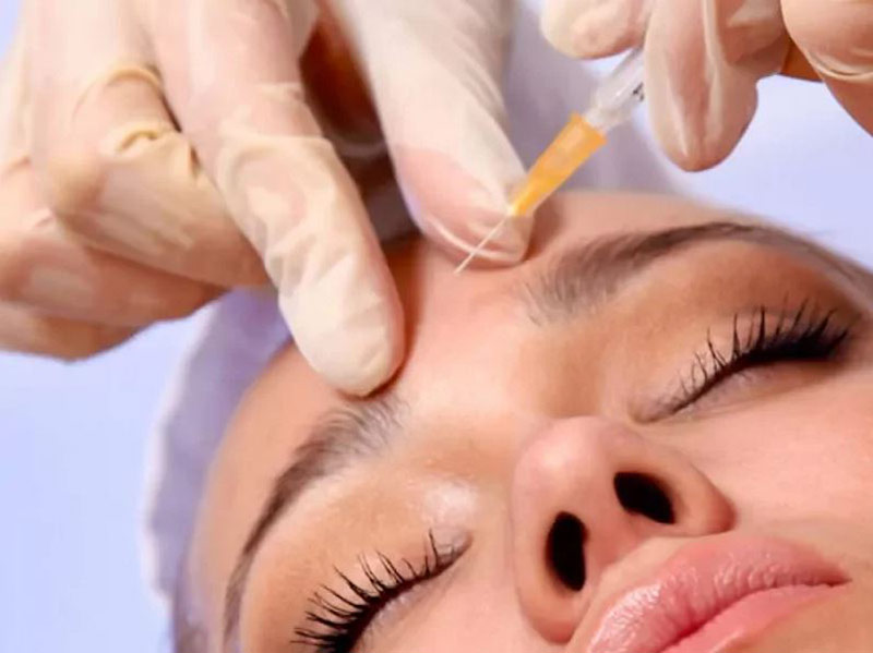 بوتاکس طبیعی صورت بدون حالت منجمد