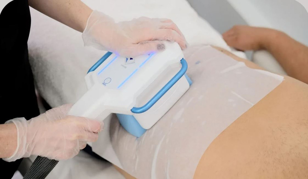 بوتاکس لاغری یا کرایولیپولیز کدام موثرتر