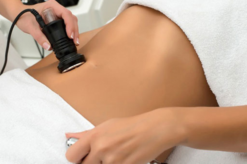 بوتاکس لاغری یا RF فرکشنال