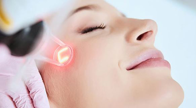 اگزوزوم یا لیزر فرکشنال صورت