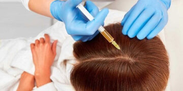 اگزوزوم تراپی مو