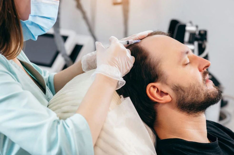 اگزوزوم برای درمان ریزش مو