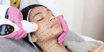 جوانسازی پوست با روش ترماژ