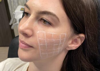 Skinvive محصول جدید برای صافی پوست