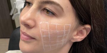 Skinvive محصول جدید برای صافی پوست