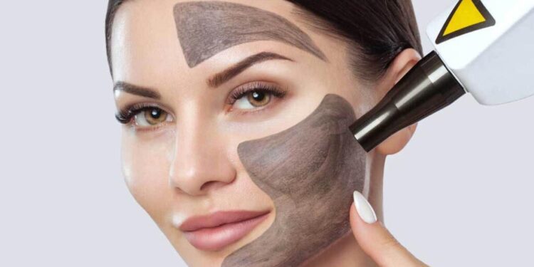 كربن تراپي صورت