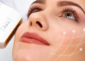 اولتراپی برای سفت کردن پوست صورت