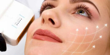 اولتراپی برای سفت کردن پوست صورت