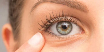 روغن آفتابگردان برای جوانسازی زیر چشم