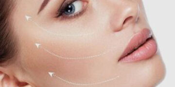 فرق نخ لیفت با نخ کلاژن در جوانسازی پوست