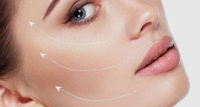 فرق نخ لیفت با نخ کلاژن در جوانسازی پوست