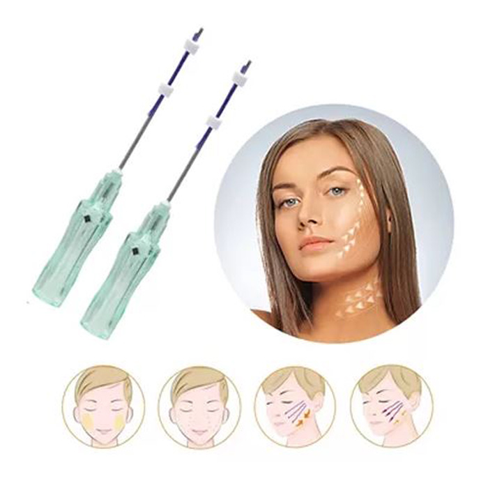 انواع نخ لیفت صورت