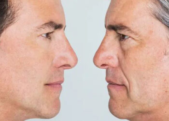 معجزه سلول بنیادی دستگاه جی‌ سل در جوانسازی