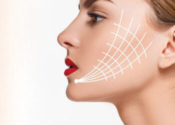 نخ امبدینگ برای لاغری صورت