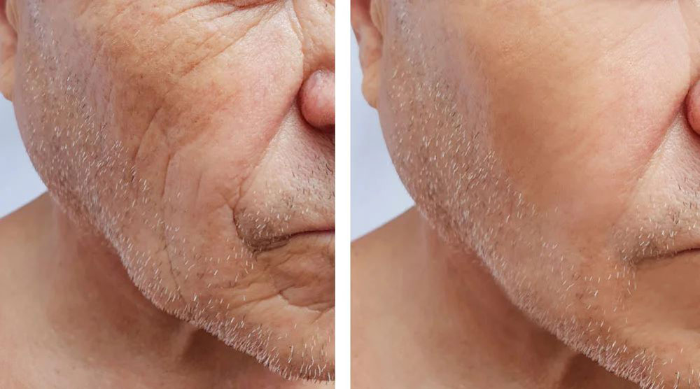 سلول های بنیادی از کجا برای جوانسازی گرفته میشود