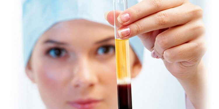 کرم پی آر پی لیپوزومال روش نوین جوانسازی